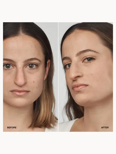 Clinique Even Better Clinical Serum Foundation SPF20 30ml (Various Shades) Clinique — detalhe 4