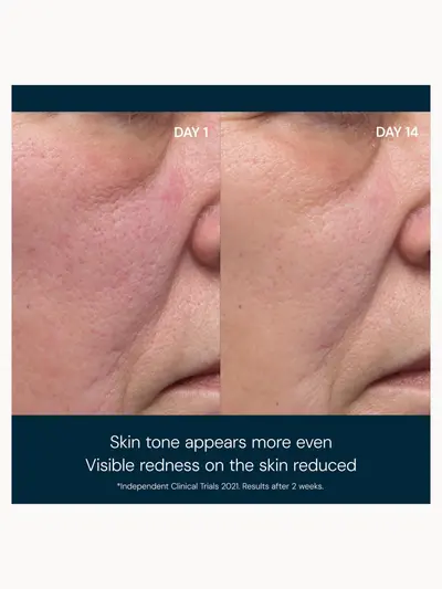 Elemis Dynamic Resurfacing Facial Pads 14 Pads Elemis — detalhe 8