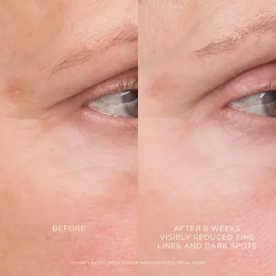 Equilibrium Resurfacing Retinoid Treatment Hourglass — detalhe 4