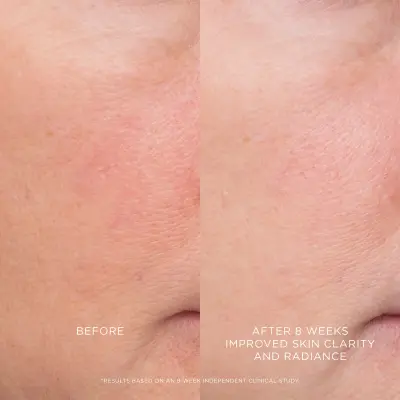 Equilibrium Resurfacing Retinoid Treatment Hourglass — detalhe 5