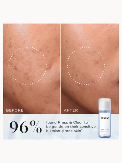 Medik8 Press and Clear Refill 150ml Medik8 — detalhe 4