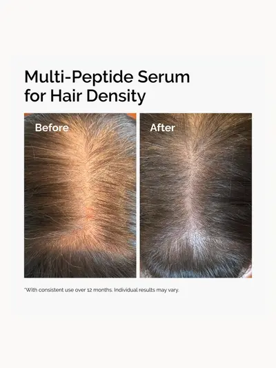 The Ordinary's Multi-Peptide Serum for Hair Density and Scalp Support 60ml The Ordinary — detalhe 3