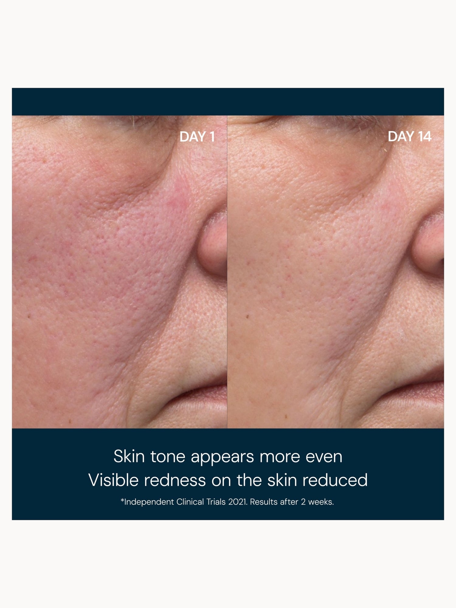 Elemis Dynamic Resurfacing Facial Pads 14 Pads Elemis — detalhe 8