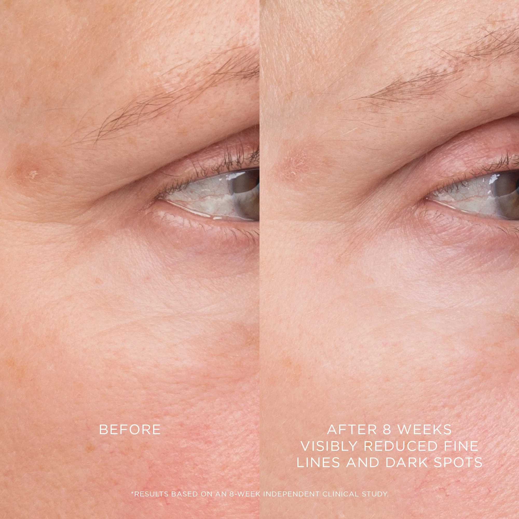 Equilibrium Resurfacing Retinoid Treatment Hourglass — detalhe 4