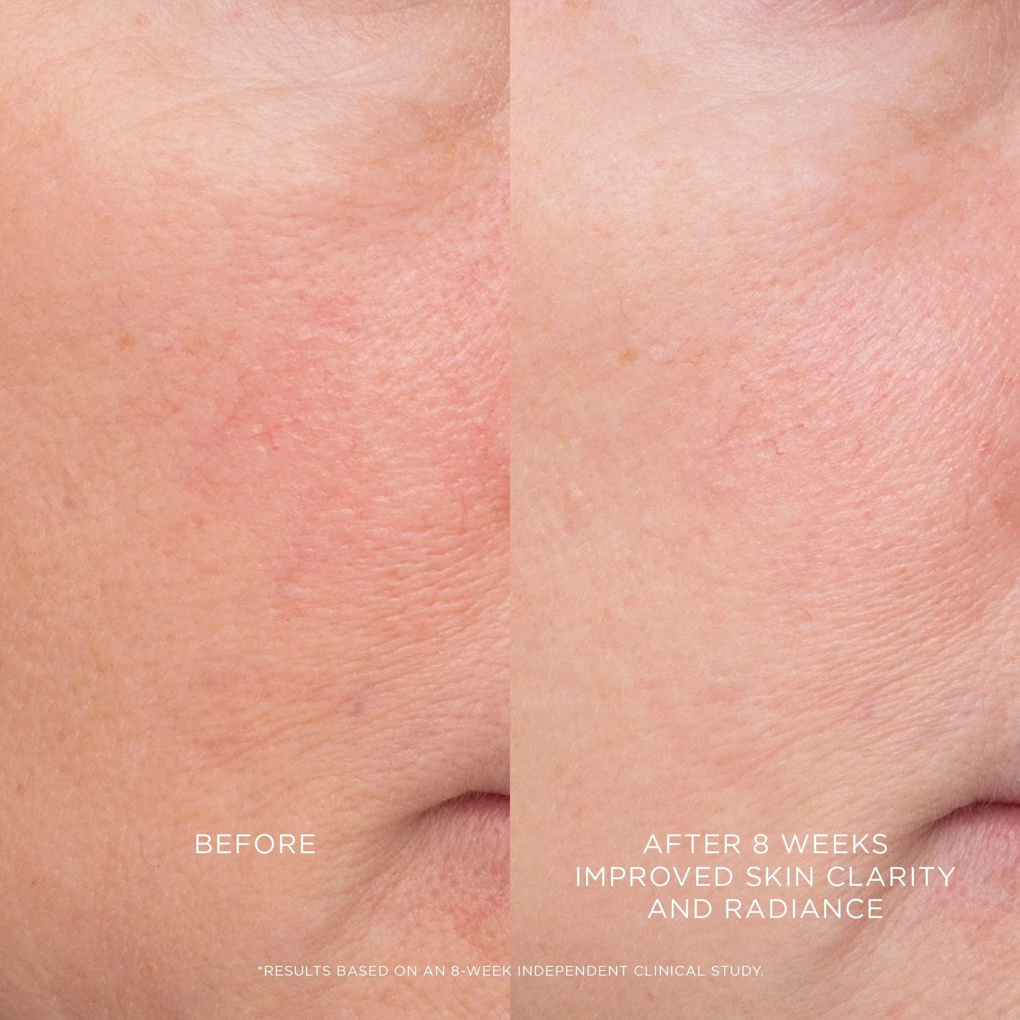 Equilibrium Resurfacing Retinoid Treatment Hourglass — detalhe 5