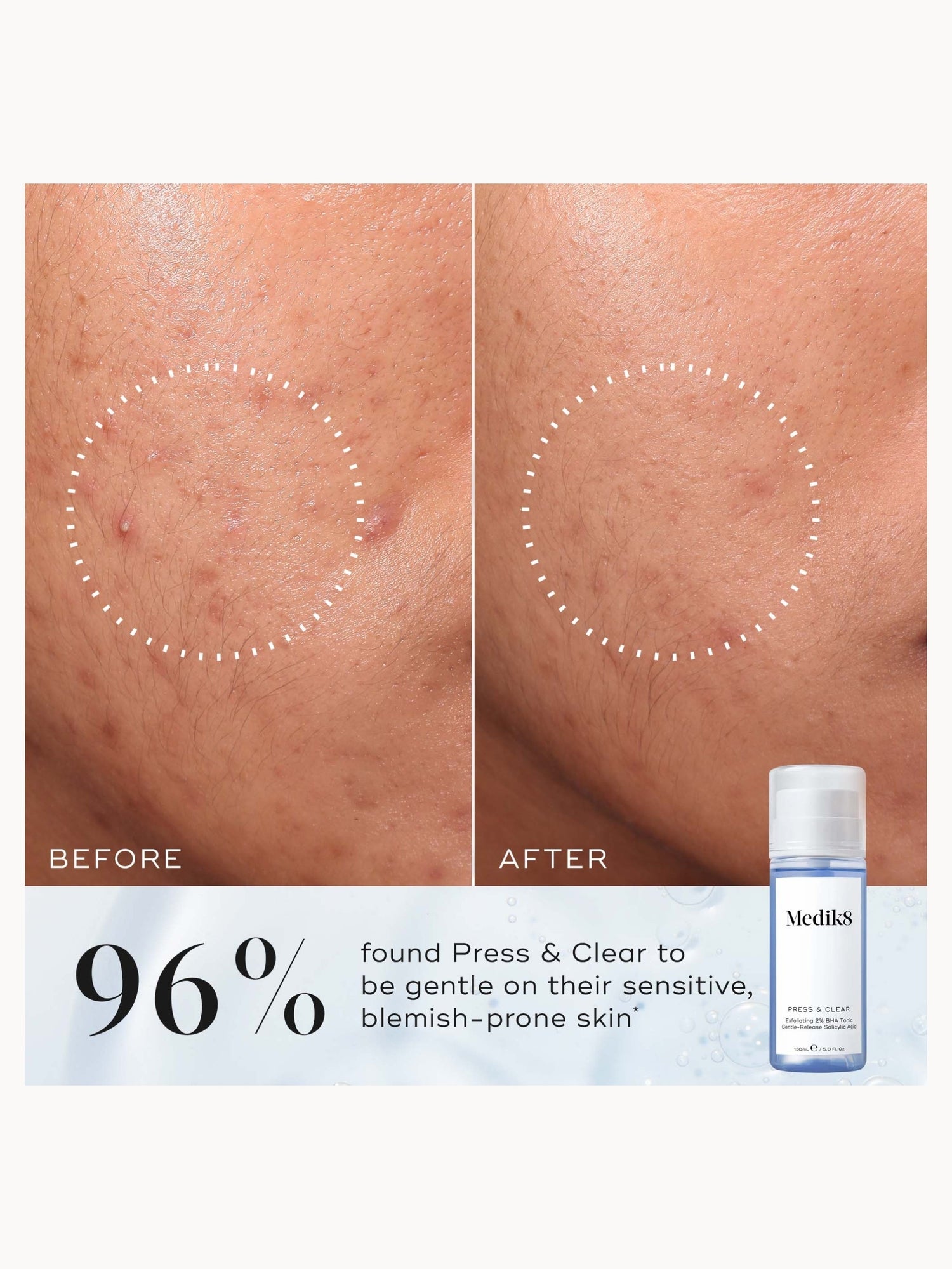 Medik8 Press and Clear 150ml Medik8 — detalhe 4