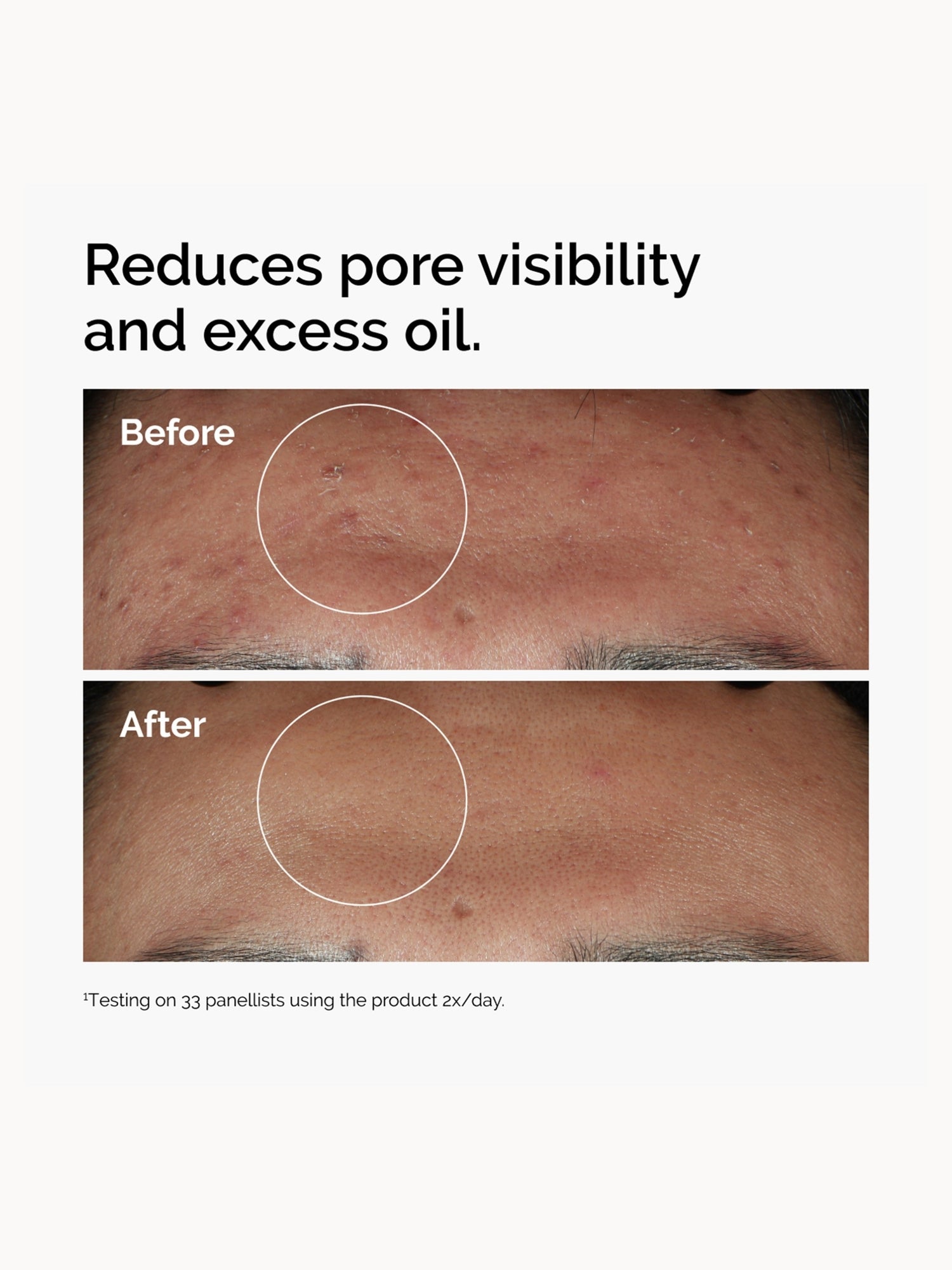 The Ordinary Niacinamide 10% + Zinc 1% Supersize Serum 60ml The Ordinary — detalhe 6