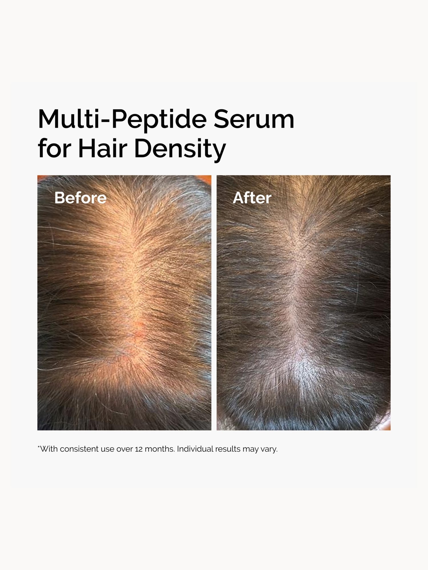 The Ordinary's Multi-Peptide Serum for Hair Density and Scalp Support 60ml The Ordinary — detalhe 3